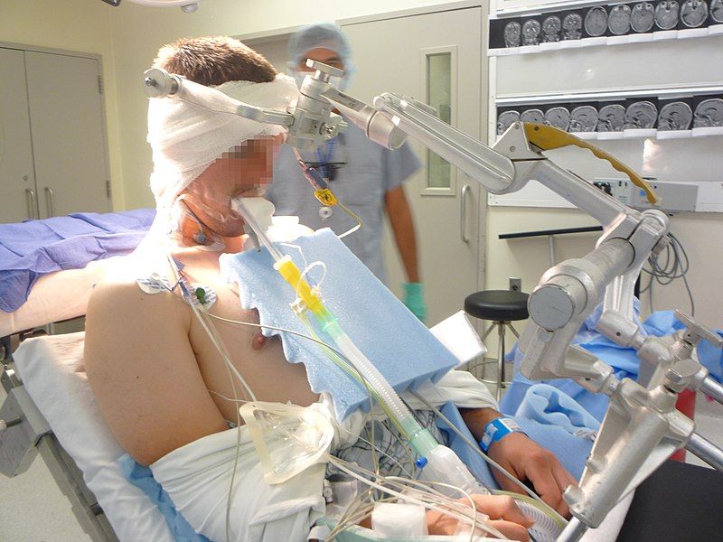 File:Sitting craniotomy.jpg