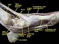 Ankle joint. Deep dissection. Medial view