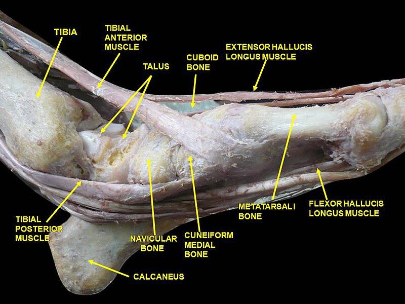 File:Slide2wewe.JPG