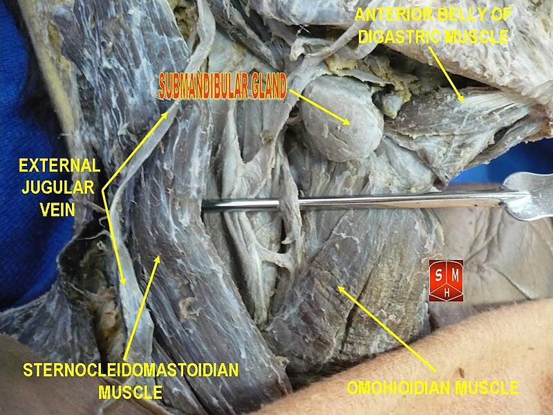 File:Submandibular gland.jpg