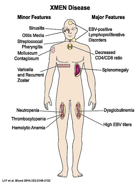 File:XMEN Clinical Manifestations.jpg