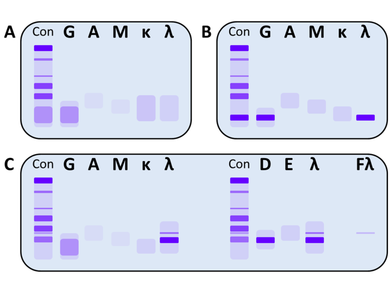 File:Immunfixation schematisch 2.png