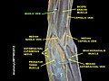 Basilic vein