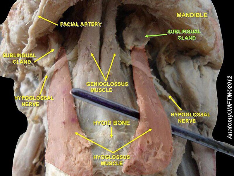 File:Slide14ww.JPG