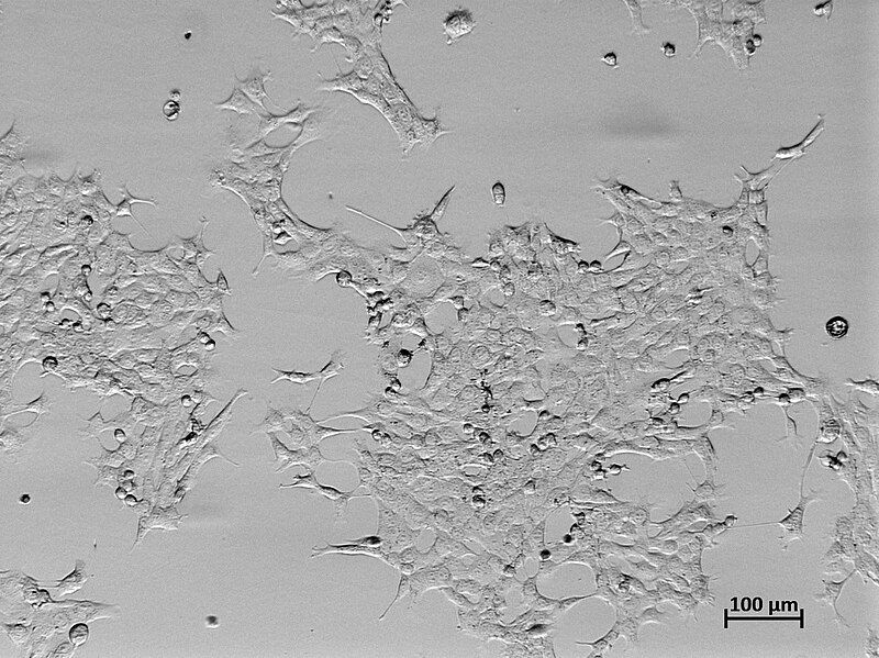 File:4T1 cell line.jpg