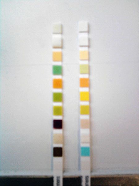 File:Comp.Urine.Test.Strip.jpg