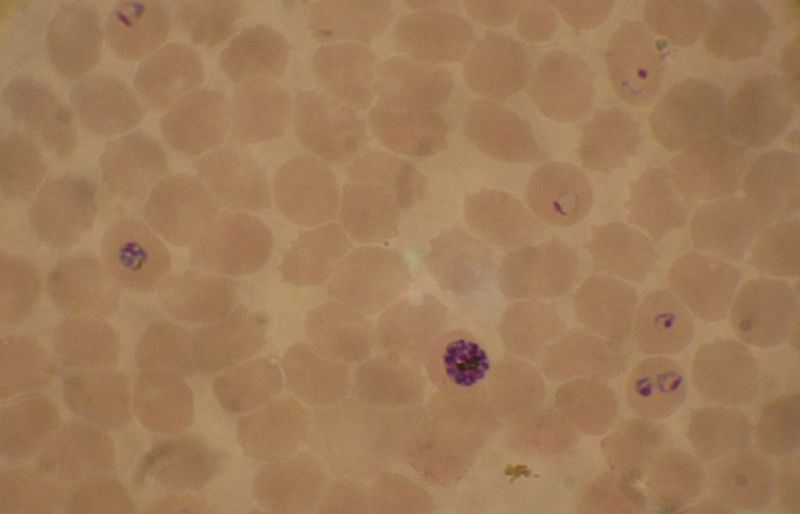 File:Plasmodium falciparum 02.jpg