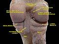 Knee joint. Deep dissection. Posterior view.