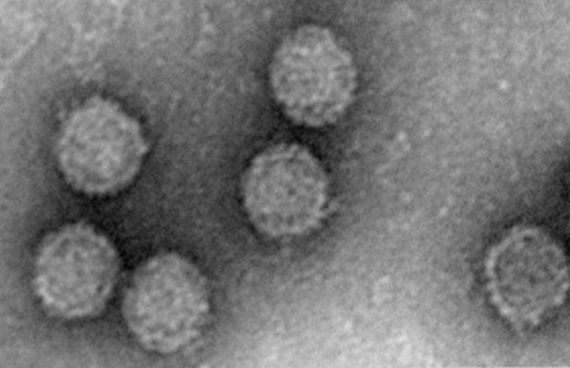 File:Viruses-10-00555-g001-A.jpg