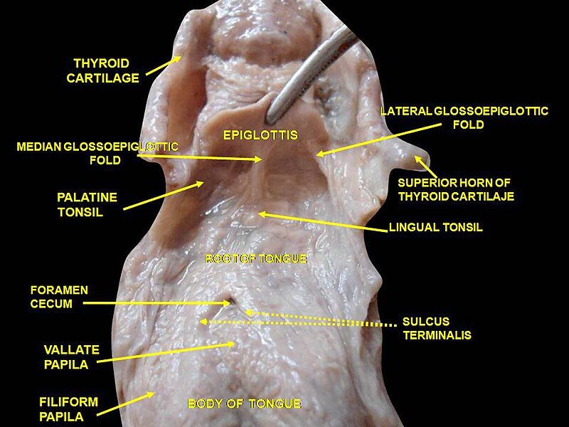 File:Slide1DEEAA.JPG