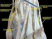 Muscle of the hand . Posterior view.