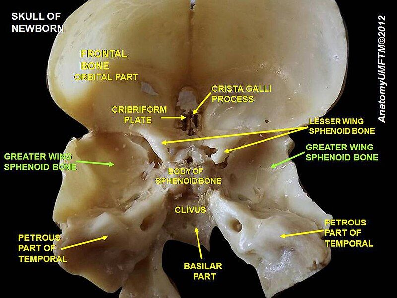 File:Slide3pppp.JPG