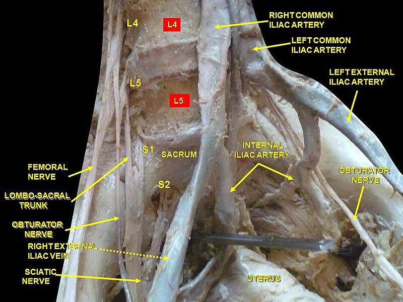 File:Slide1erer.JPG