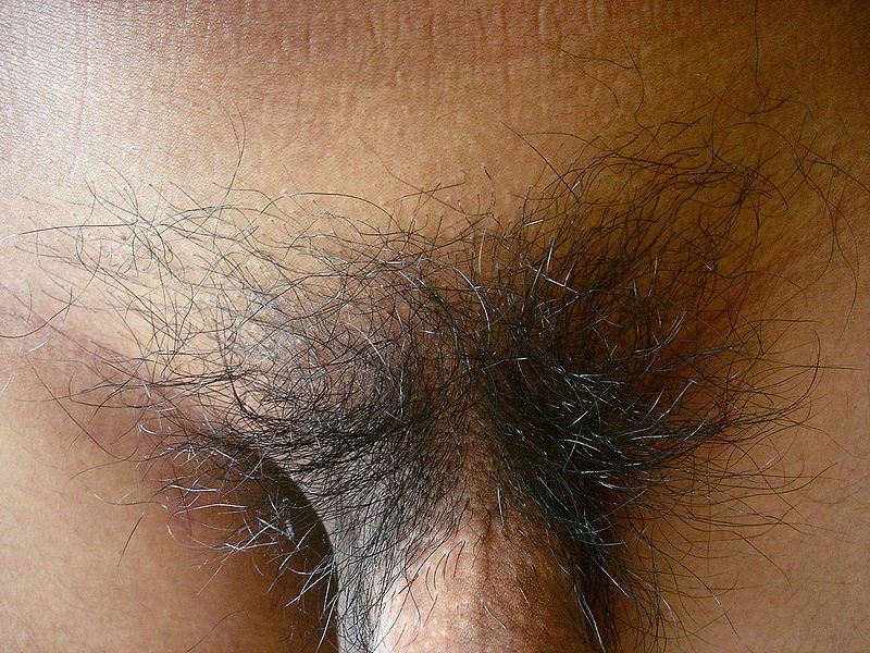 File:Male pubic hair.JPG