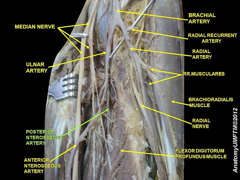 File:Slide7PPPP.JPG