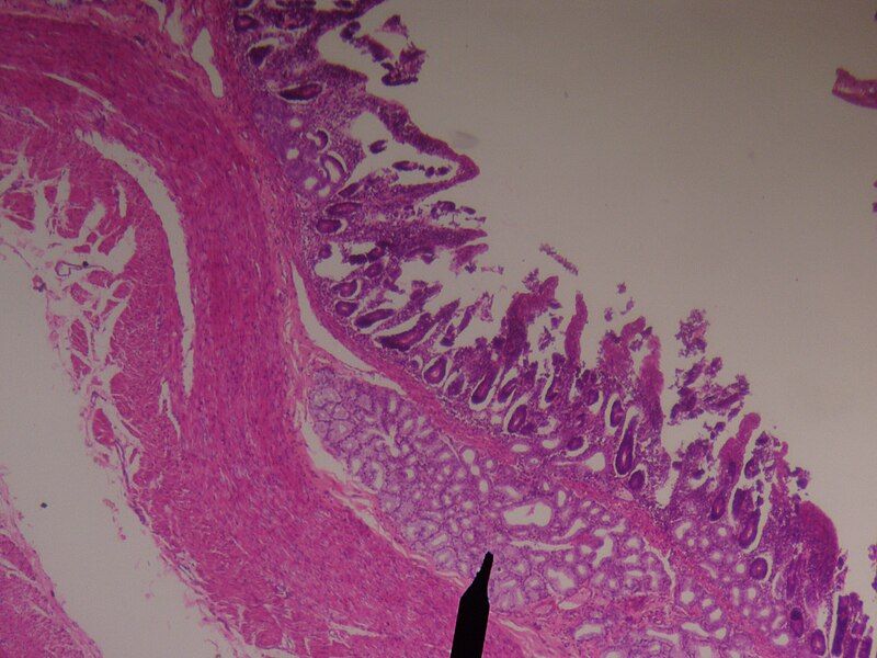 File:Duodenum-brunner's glands.JPG