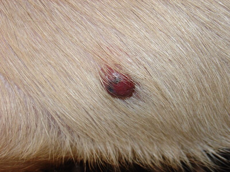 File:Hemangiosarcoma of skin.JPG