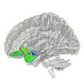 Tractography showing uncinate fasciculus.