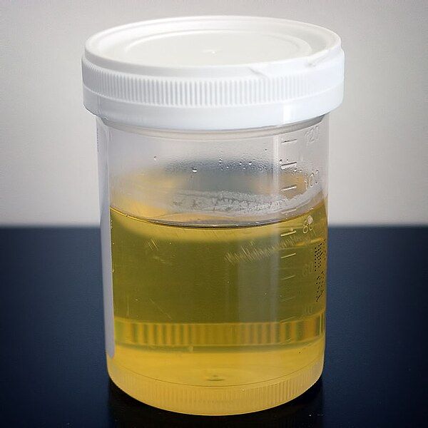 File:Urine sample.JPG