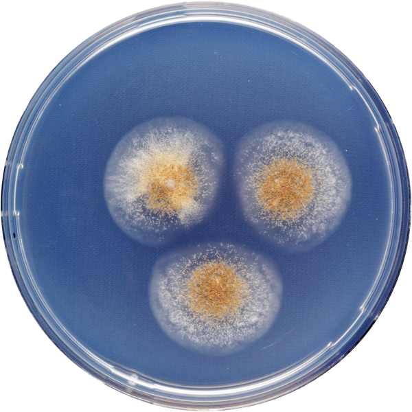 File:Aspergillus anthodesmis cya.png