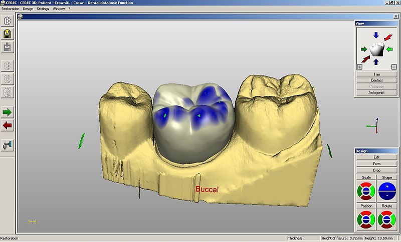 File:CEREC-krona.jpg