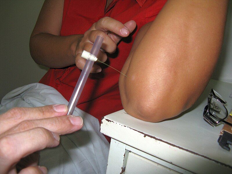 File:Monofilament testing.jpg