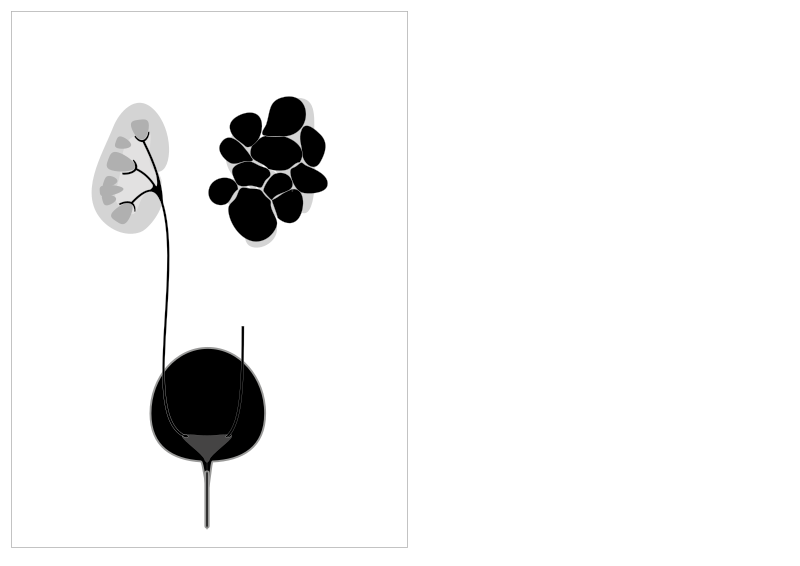 File:Multicystic Dysplastic kidney.svg