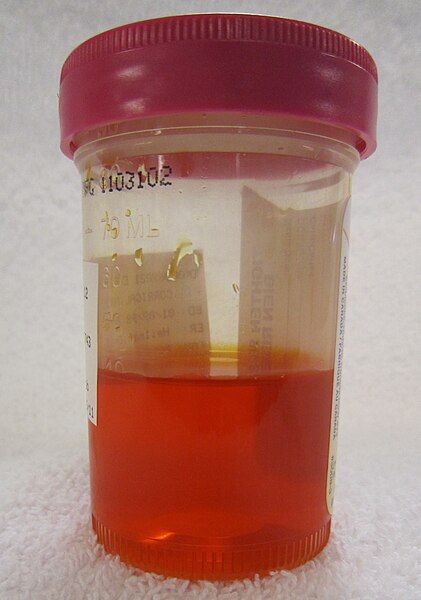 File:Pyridiumurine.jpg