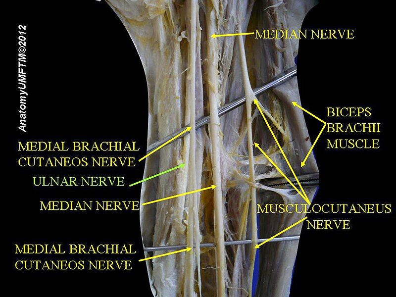 File:Slide2hhhh.JPG