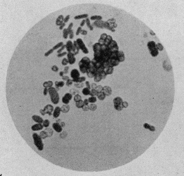 File:Azotobacter cells.jpg