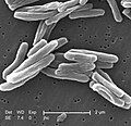 M. tuberculosis cells