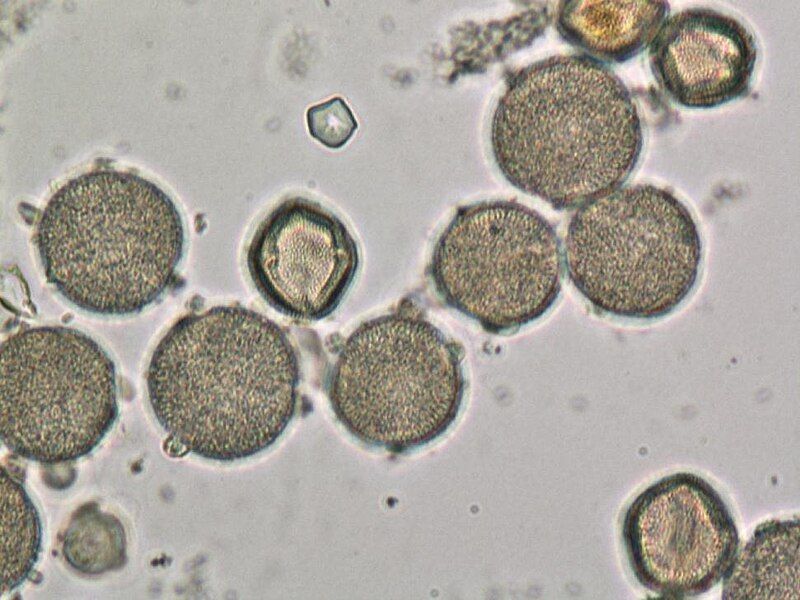 File:Pollen samples.jpg