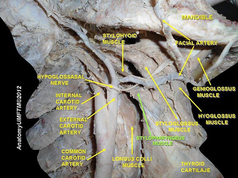 File:Slide16aaa.JPG