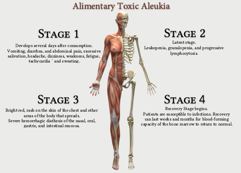 File:Alimentary Toxic Aleukia.png