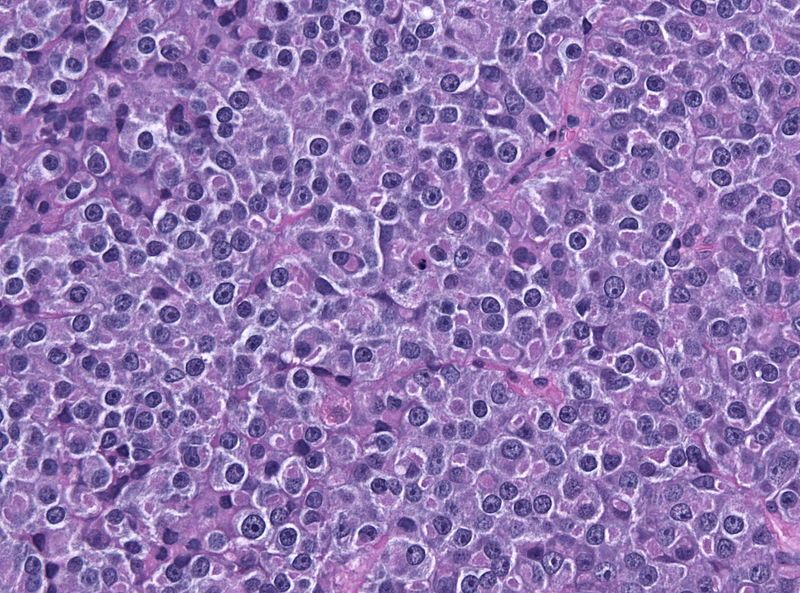 File:PRL HE histology.jpg