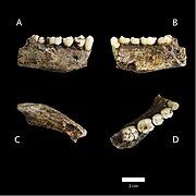 (A,B,C,D) Views of one lower jaw