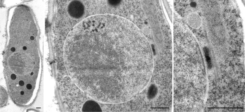 File:Schizosaccharomyces pombe tsentrosoom.jpg