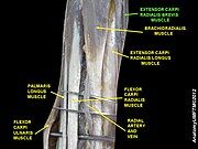 Extensor carpi radialis brevis muscle