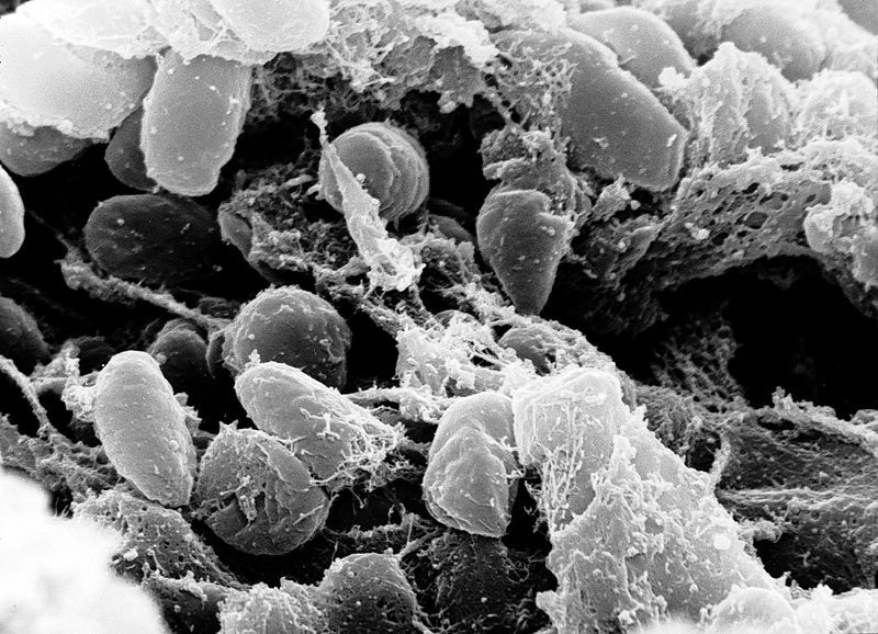 File:Yersinia pestis.jpg