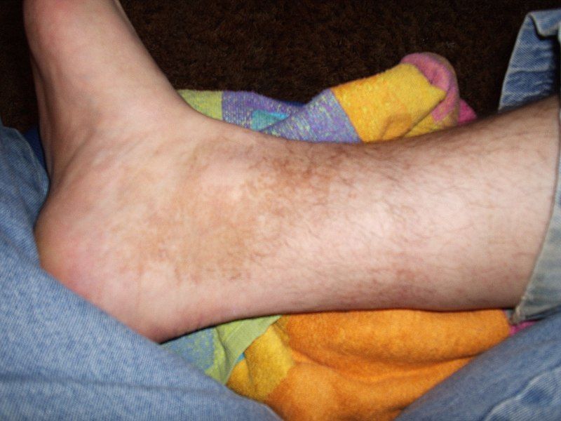 File:Foot 002.jpg