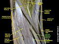 Vastus medialis muscle