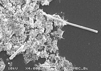 Filamentation (top right of electron micrograph) occurs in some bacteria when PBP3 is inhibited.[6]