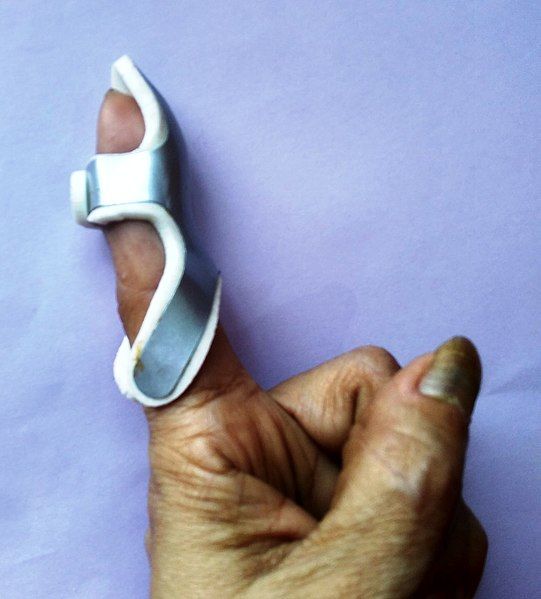 File:Finger splint.jpg