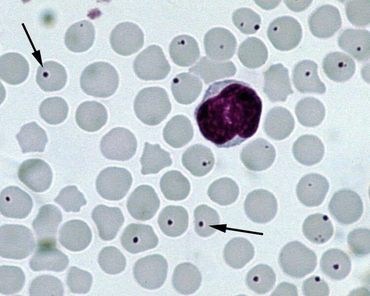 File:Anaplasma-centrale-cattle-blood-Giemsa-stain.jpg