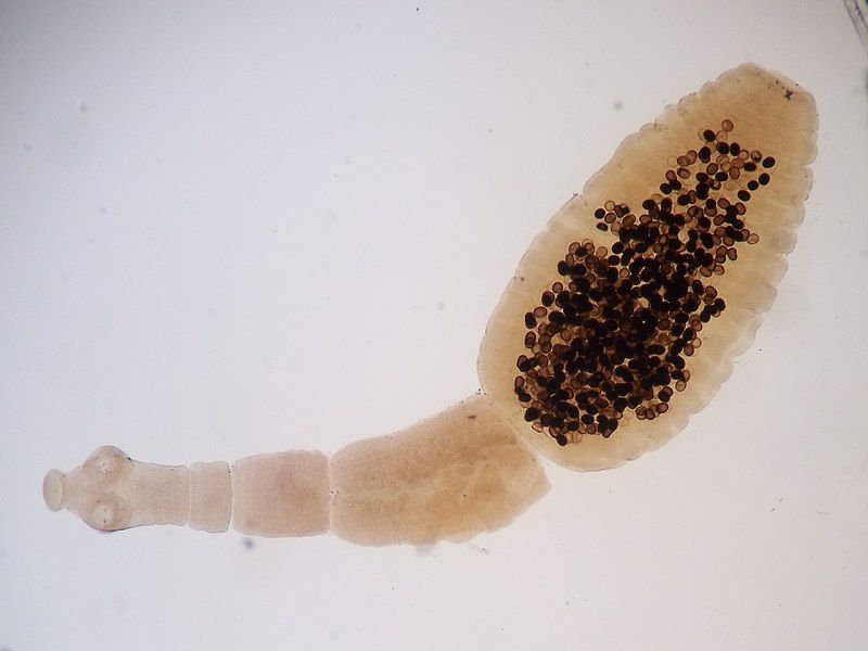 File:Echinococcus granulosus.JPG