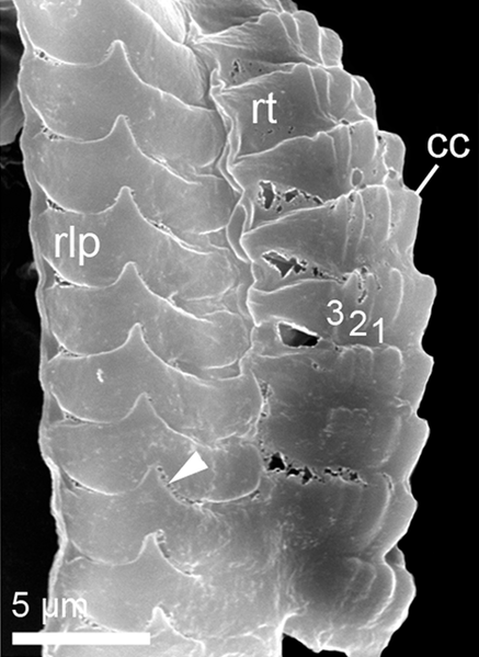 File:Pontohedyle milaschewitchii radula.png