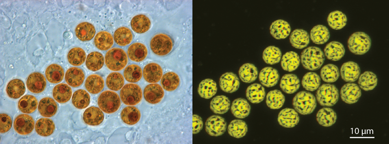 File:SymbiodiniumCell Lightandconfocal copy.png