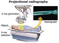 Projectional radiography Attribution-Share Alike 4.0 International license, attributed to Blausen Medical and Mikael Häggström