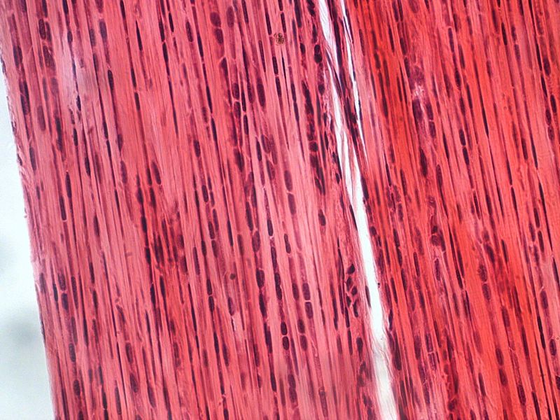 File:Dense connective tissue-400x.jpg