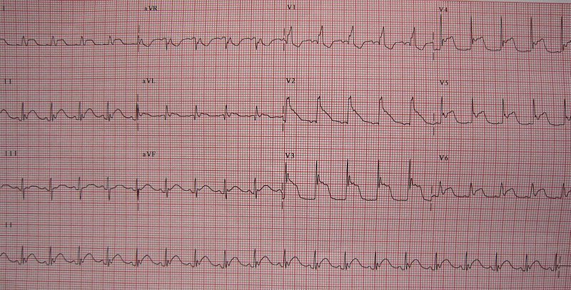 File:CNSinjury.JPG